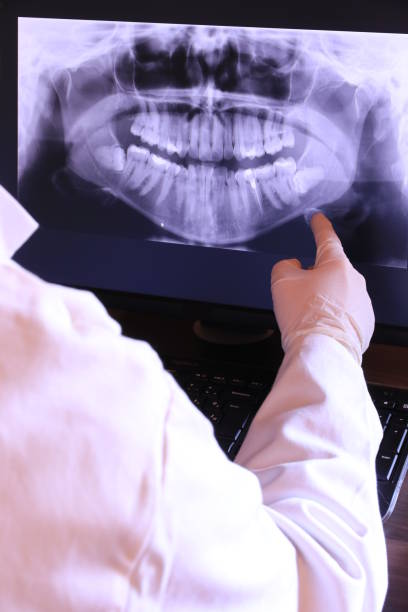 Best Emergency Root Canal Treatment in Carthage, MS